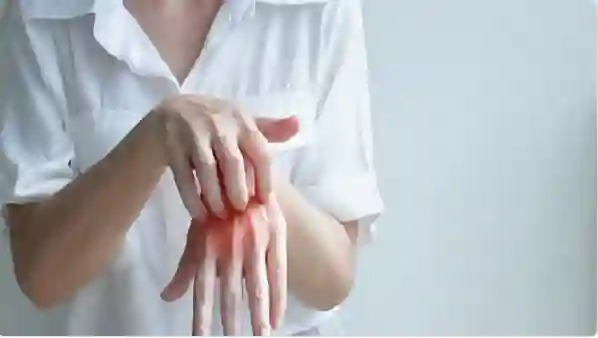 خطأ تقع فيه عند السكن في الفنادق قد يسبب إصابتك بالجرب 