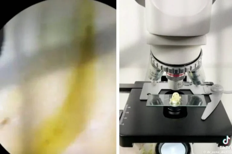 فيديو مذهل لما وجده مختص داخل الاندومي الذي يباع في السعودية اثناء فحصة تحت المجهر 